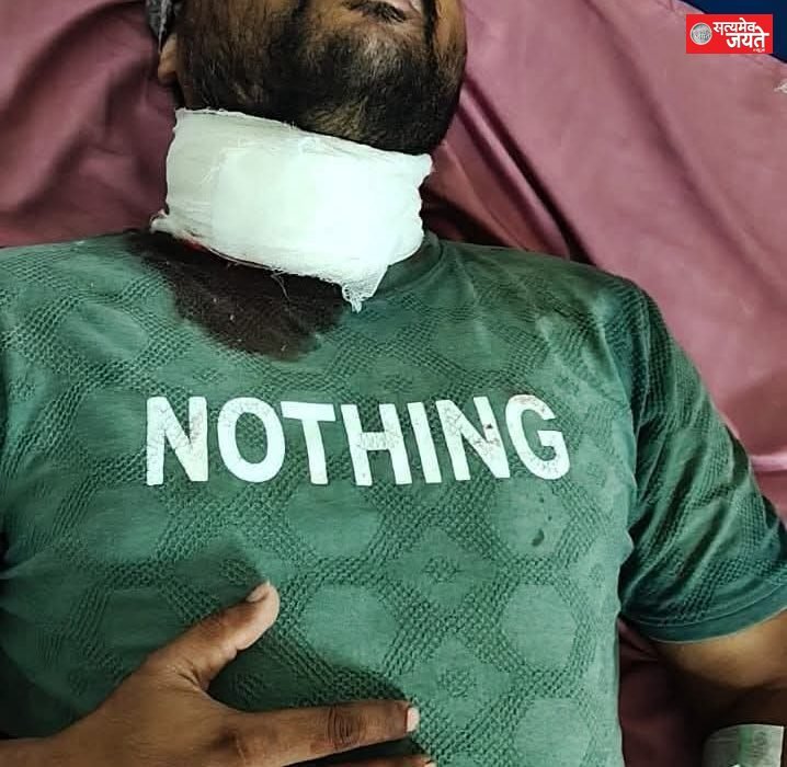 जौनपुर में चाइनीज मांझे का कहर: बाइक सवार युवक की गर्दन कटी