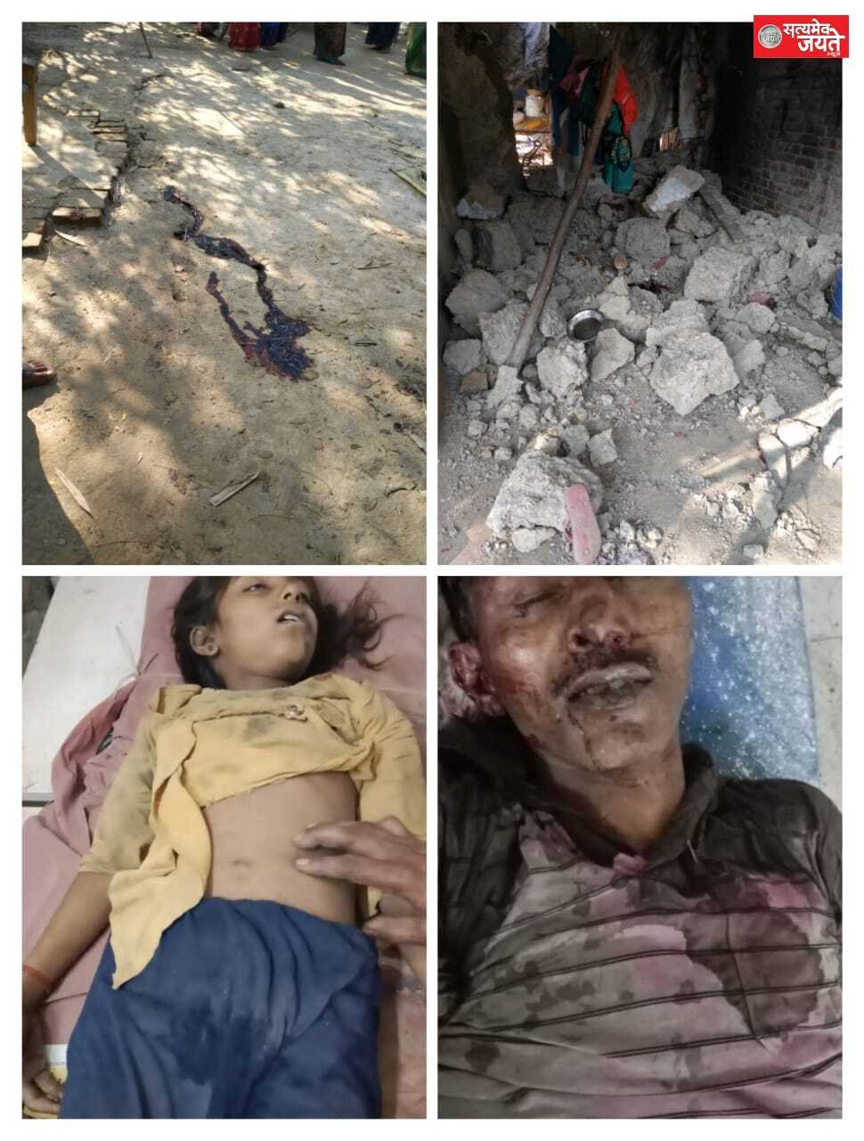 पिता – पुत्री की मौत दूसरी घायल बेटी का चल रहा है इलाज हालत स्थिर मकान की कच्ची दीवार गिरने से हुई घटना